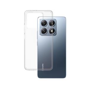 Fashionable Case Transparent X-Ray Soft Basic Xiaomi 14T 4G